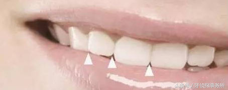 好看的牙齿标准（牙齿的7大美学标准）